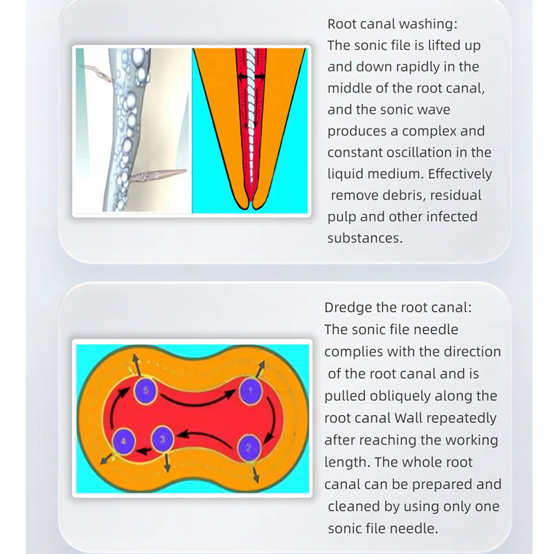 MM phoenix Style Dental Air Sonic Endo Handpiece with Tips