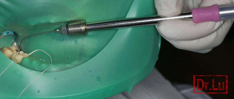 Endo Aspirator